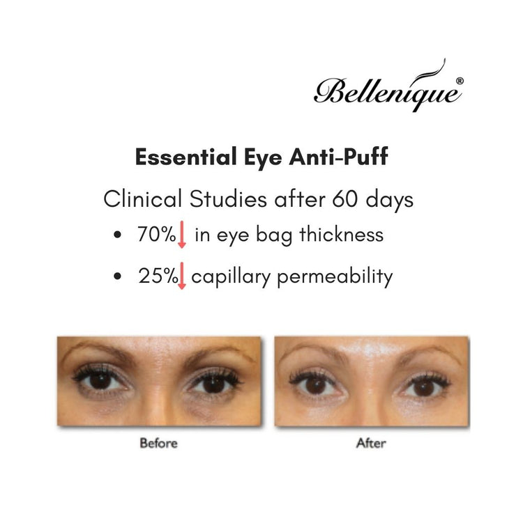 Bellenqiue Essential Anti-Puff DE-PUFF FIRMS and TIGHTENS 15ml Made in USA - BEAUT.