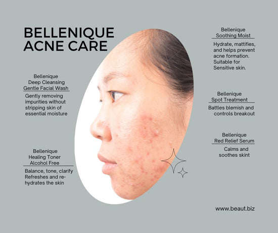 How To Care For Acne --- Bellenique Acne and Blemish Care