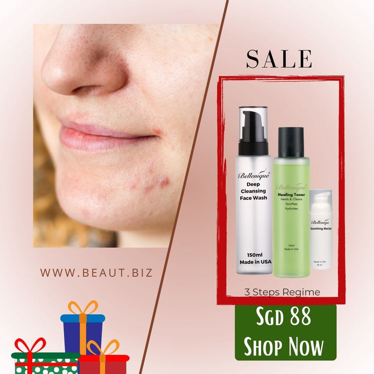 Christmas Set for Acne, Sensitive and Oily Skin. Made in USA