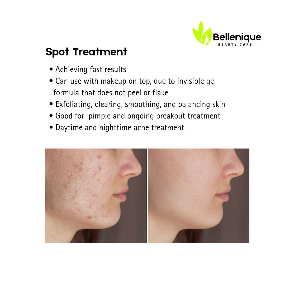Bellenique Spot Treatment Exfoliating, clearing, smoothing, and balancing skin • Good for  pimple and ongoing breakout treatment • Daytime and nighttime acne treatment Can use with makeup on top, due to invisible gel formula that does not peel or flake