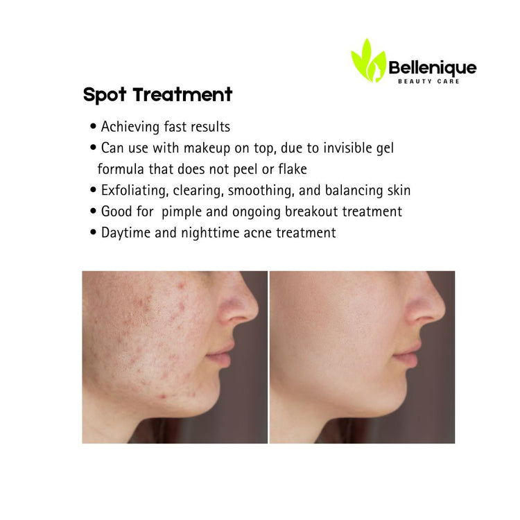 Bellenique Spot Treatment Exfoliating, clearing, smoothing, and balancing skin • Good for  pimple and ongoing breakout treatment • Daytime and nighttime acne treatment Can use with makeup on top, due to invisible gel formula that does not peel or flake